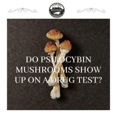 Does Mushrooms Show Up on a Drug Test? Exploring the Psychedelic and the Practical