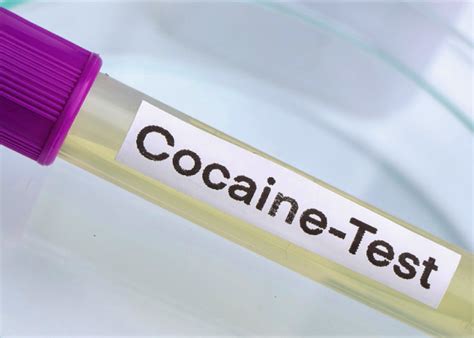 How Long Does Cocaine Show Up in Drug Test: A Dive into the Unpredictable World of Time and Molecules